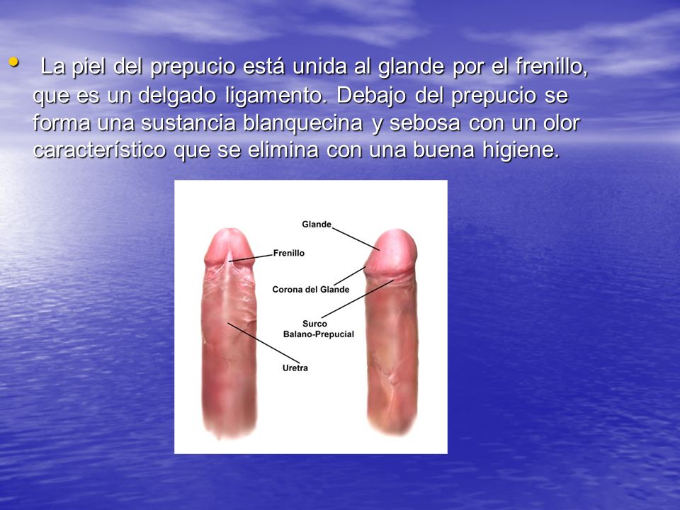Que pasa cuando se rompe el frenillo del hombre